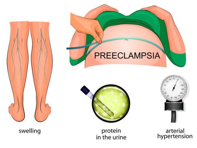 https://hopehealthhealing.ug/blog/what-preeclampsia-preeclampsia-awareness-month-2022